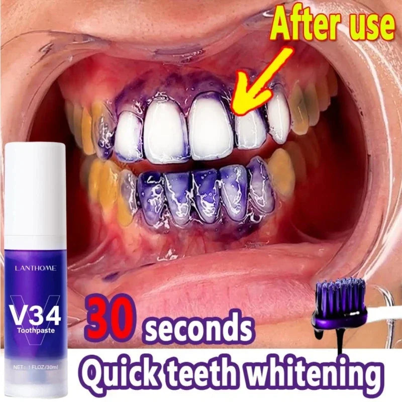 V34 Pro Branqueador dental